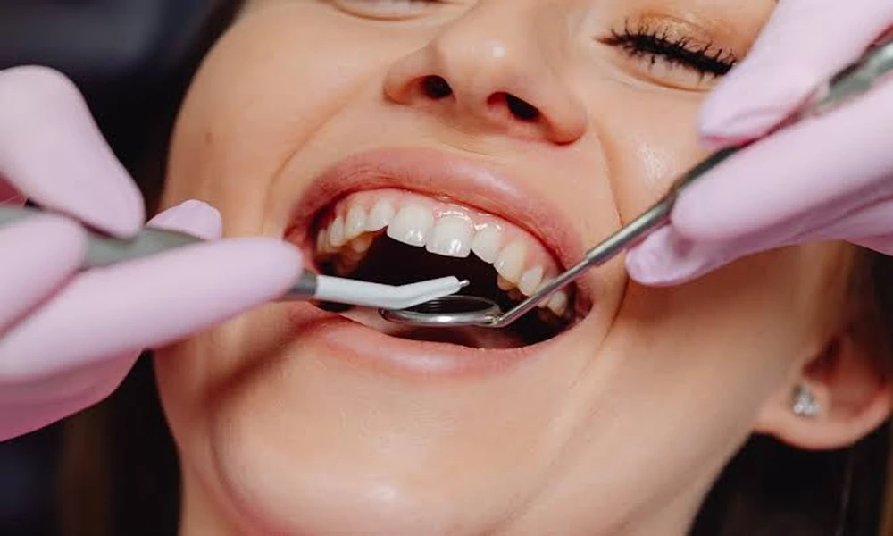 Top 8 Cosmetic Dentistry Clinics Across London for Understanding Treatment Guarantees