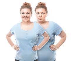 What to Expect Before and After Bariatric Surgery